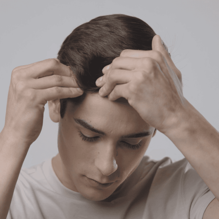 Scalp pinching technique